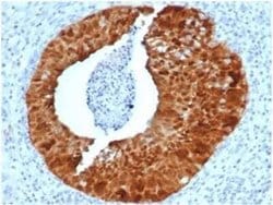 p16INK4a/CDKN2A Rabbit anti-Human, Clone: CDKN2A/4844R, Novus Biologicals